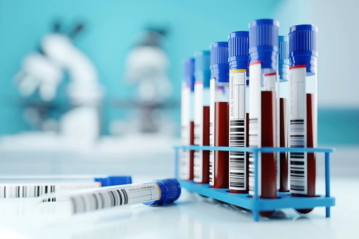 Image representing Get Test Results