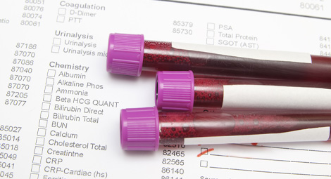 Vials for collecting blood tests